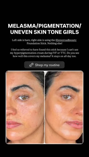 Jones Road Beauty before / after ad: If you need a sign to refresh your makeup, here it is. I've been loving Jones Road for a quick, effortless refresh. It gives my skin a hydrated glow…